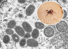 Wetland-virus